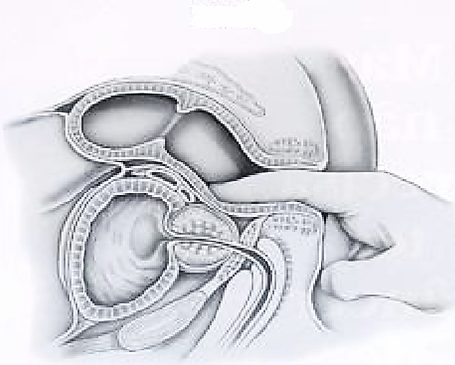 Anatomía de la próstata y su relación con la vejiga y la uretra