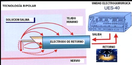 Tecnología bipolar