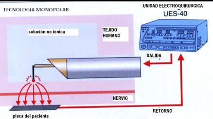 Tecnología monopolar