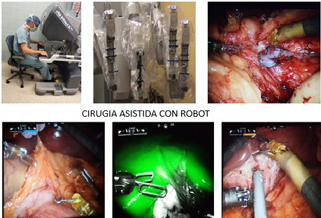 Cirugía Asistida con Robot