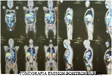 Medicina Nuclear y PET