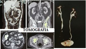 Tomografía y Resonancia